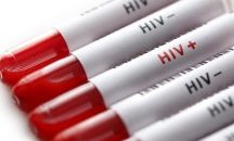 РЗИ в Разград обявява Дни на отворените врати за превенцията на ХИВ